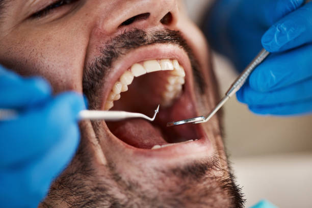 Fast & Reliable Emergency Dental Services in IA