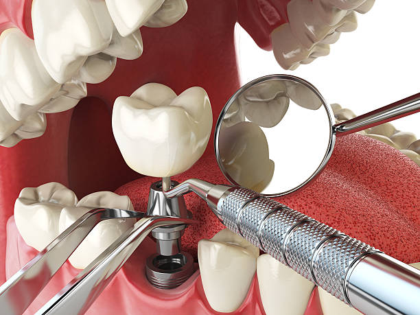 Best Pediatric Emergency Dentist in Forest City, IA